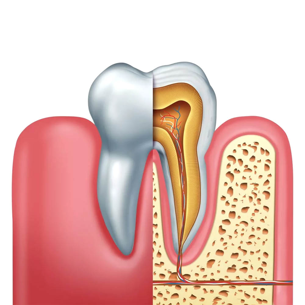 Root Canal Treatment