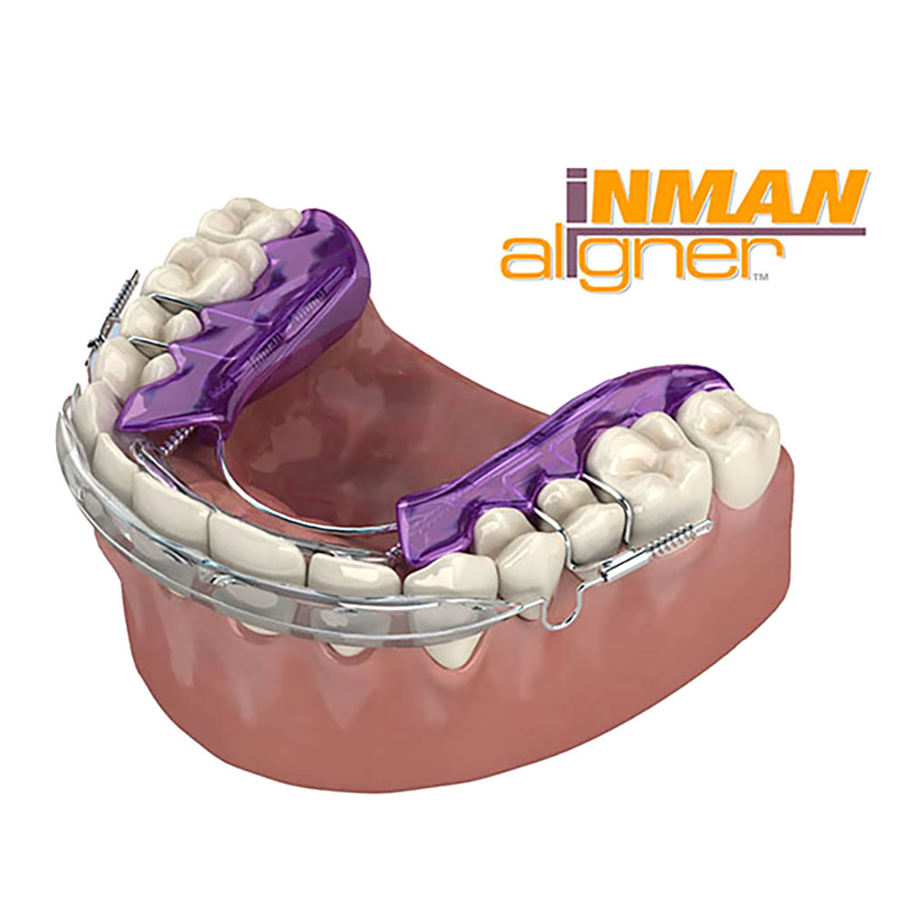 Inman Aligners